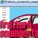 nerosunero @ frattura scomposta